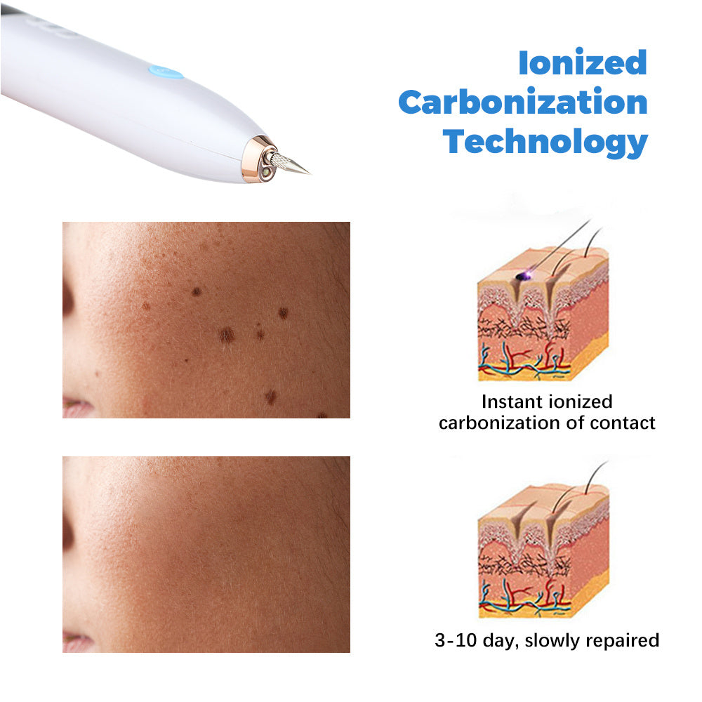 Laser Skin Tag Remover Face Mole Remove Plasma Pen Freckle Removal Machine Plasma Remove Scar Black Spot Face Wart Tattoo Device Laser Skin Tag Remover Face Mole Remove Plasma Pen Freckle Removal Machine Plasma Remove Scar Black Spot Face Wart Tattoo Device